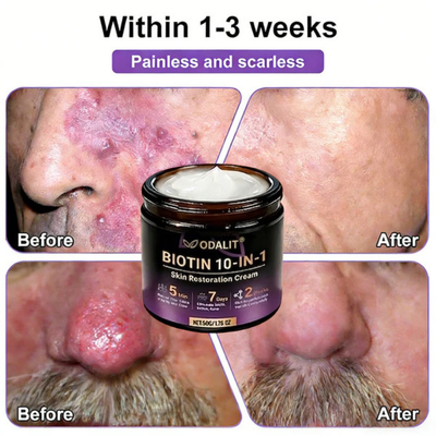 Made and Shipped from USA ✨ODALIT® Biotin 10-in-1 Skin Restoration Cream 🍀